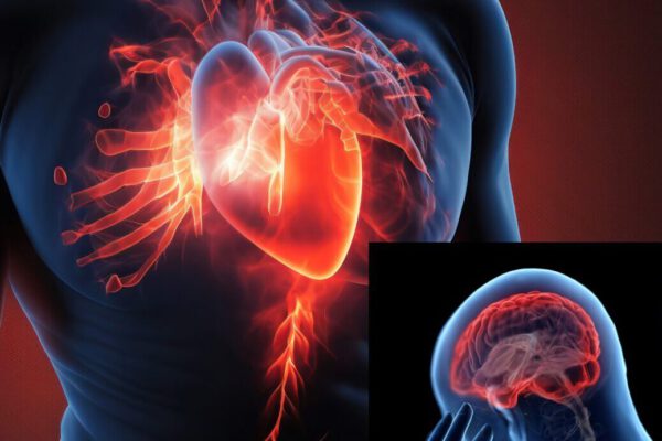 Herzinfarkt und Schlaganfall BGH